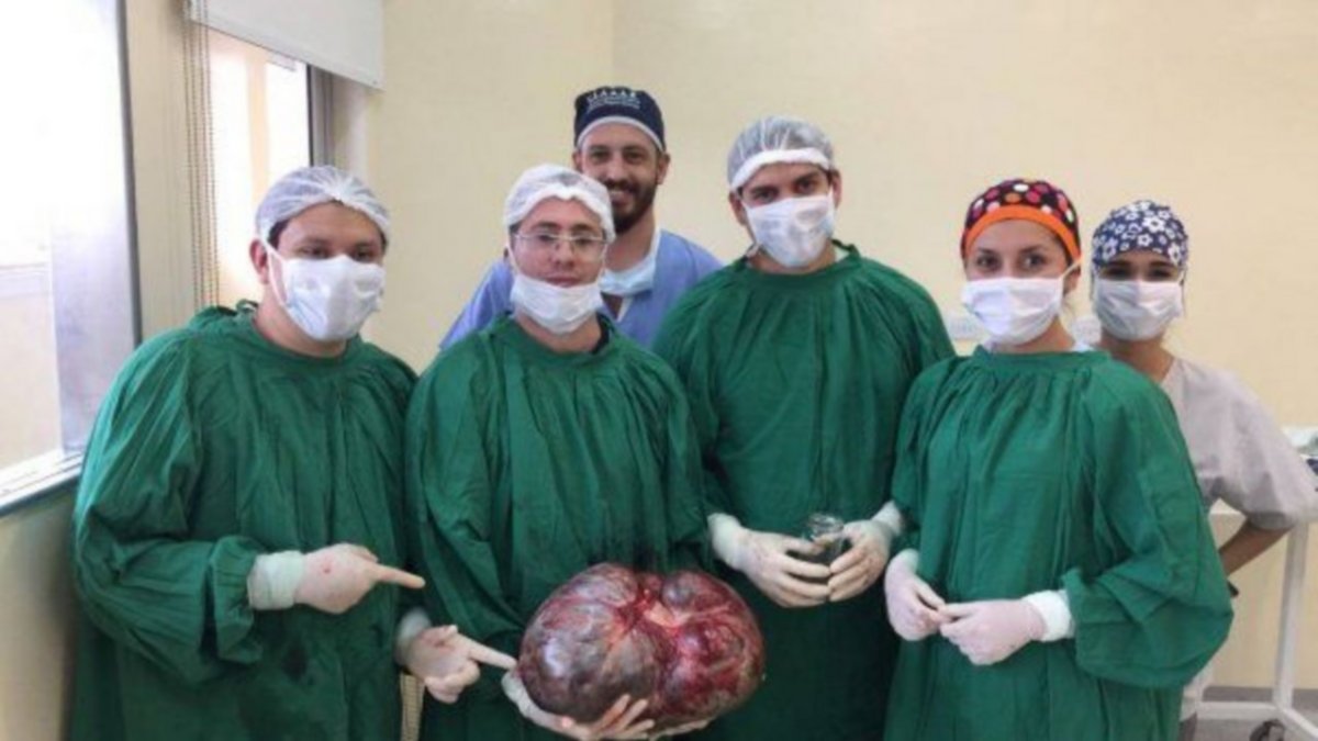 Catamarca: le extraen a una mujer un mega-tumor de 15 kilos
