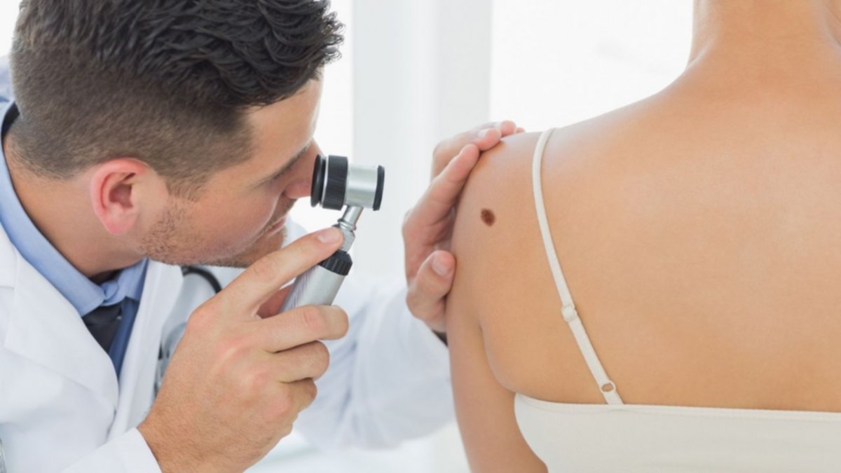 El tipo más serio y agresivo de cáncer de piel