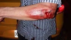Con un bate de béisbol rompió el auto y el brazo de un taxista