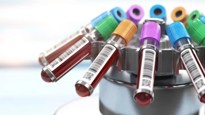 Argentina comienza ensayos con plasma de "recuperados"