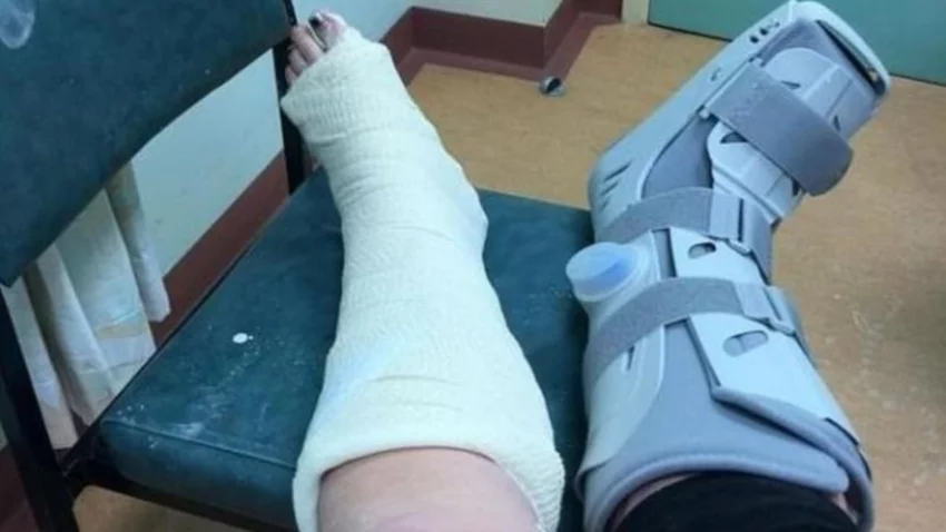 Una joven se fracturó los tobillos haciendo el reto viral de moda