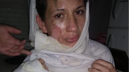 Prendió fuego a la mujer delante de sus hijas