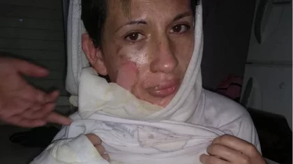Prendió fuego a la mujer delante de sus hijas