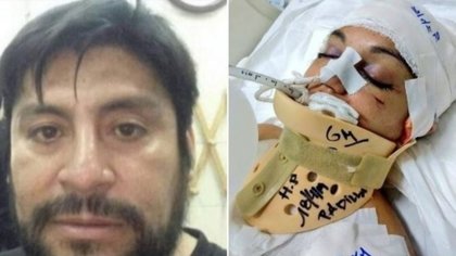 Su ex la dejó en coma: la Justicia lo podría mandar a convivir con ella