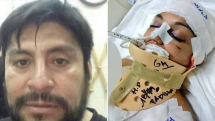 Su ex la dejó en coma: la Justicia lo podría mandar a convivir con ella