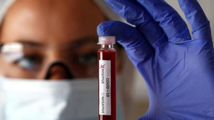 Se registraron 21 muertes y 587 contagios en la región
