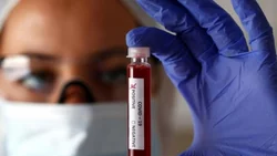 Se registraron 21 muertes y 587 contagios en la región