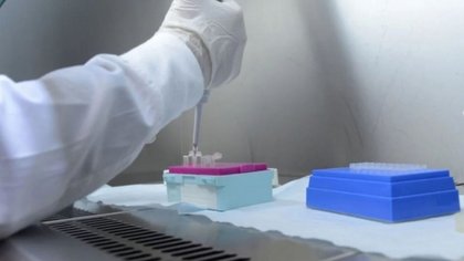 Reporte diario del país y la región