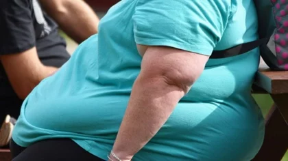 La obesidad es un factor de riesgo frente al Coronavirus