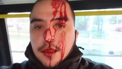 Golpearon a un colectivero, iba en marcha y con pasajeros