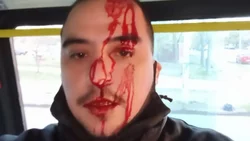 Golpearon a un colectivero, iba en marcha y con pasajeros