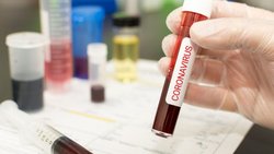 La vacuna sola no vencerá la propagación de Covid-19