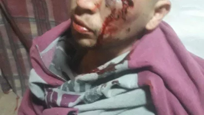 Pidió a sus jefes que le paguen y lo molieron a palos