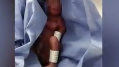 Dieron por muerto a su bebé: ¡Su papá descubrió que respiraba!