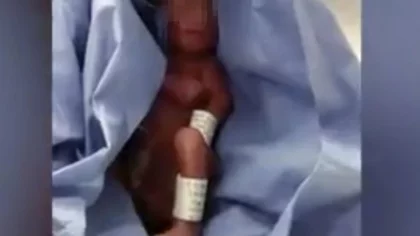 Dieron por muerto a su bebé: ¡Su papá descubrió que respiraba!