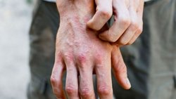 Descubrieron un nuevo síntoma tras 8 meses de pandemia