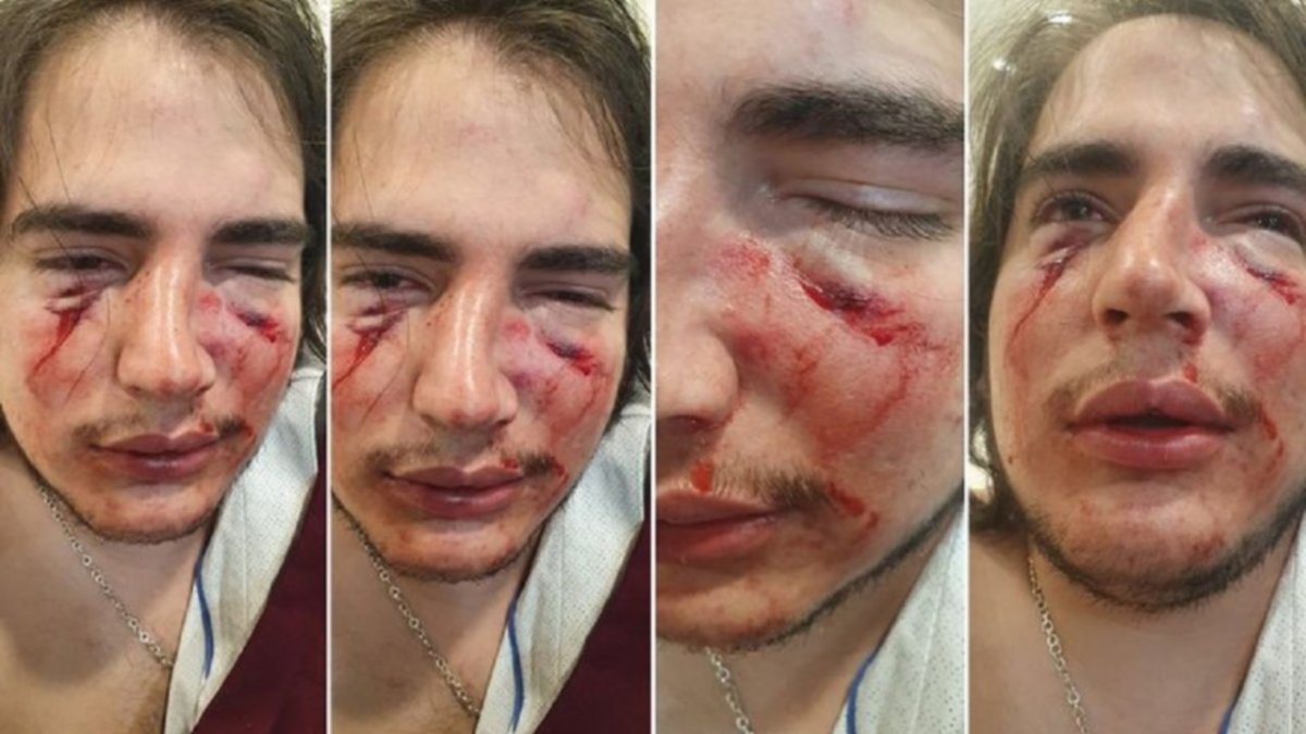 Feroz golpiza de rugbiers a joven en un country