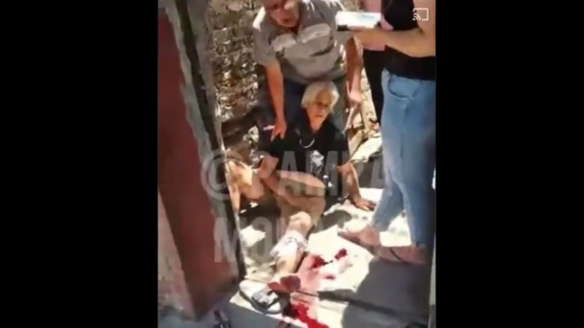 Video: Brutal ataque de un pitbull a una jubilada