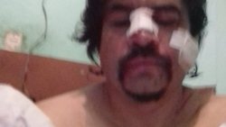 Brutal ataque a un taxista neuquino en Las Perlas