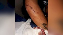 Patovicas la golpearon y dejaron inconsciente en la calle