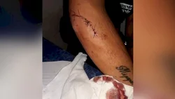 Patovicas la golpearon y dejaron inconsciente en la calle
