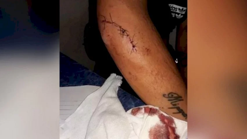 Patovicas la golpearon y dejaron inconsciente en la calle