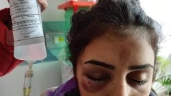Violencia entre mujeres: una joven terminó con fractura de cráneo