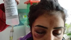 Violencia entre mujeres: una joven terminó con fractura de cráneo