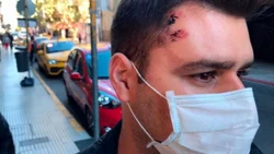 Robo piraña: frenó y cinco hombres se le metieron al auto