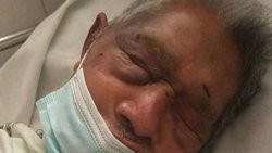Brutal ataque para robarle la jubilación: "Se está apagando"
