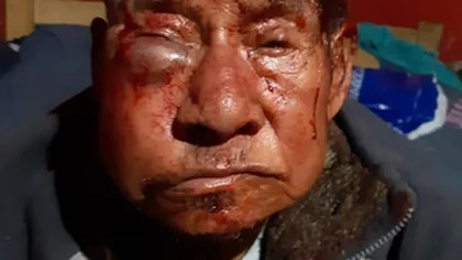 Murió el "Tata" el abuelito golpeado salvajemente