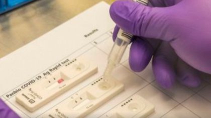Murieron 21 personas y se contagiaron 523 en la región