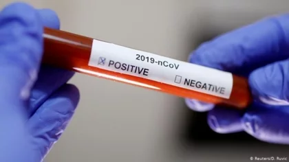 Por primera vez, Rusia registra 652 muertos por coronavirus