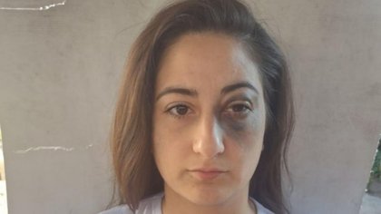 En un control un efectivo policial trompeó a una joven