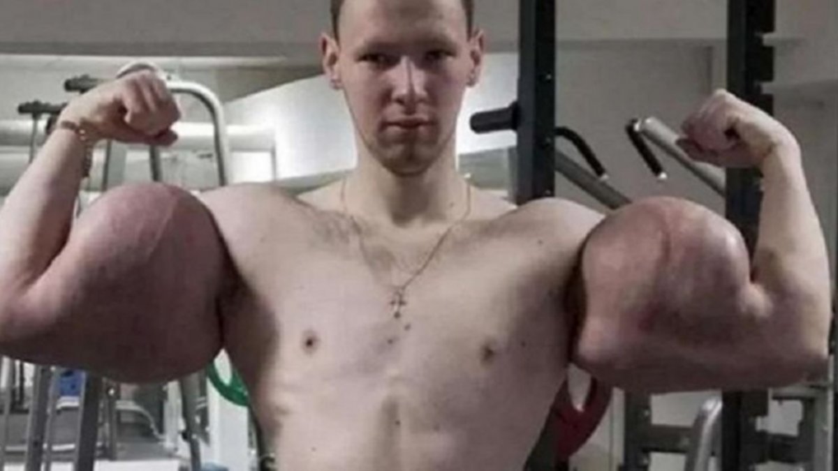 Video: Le explotaron los músculos al "Popeye ruso"