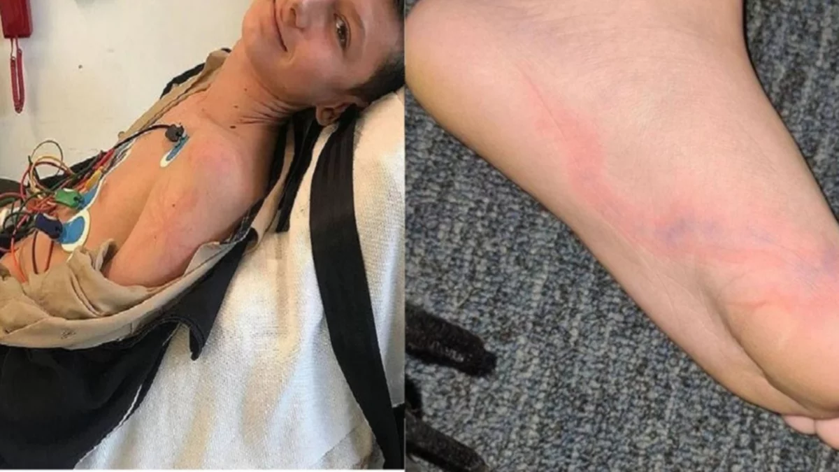 Lo alcanzó un rayo y se salvó gracias a sus zapatillas