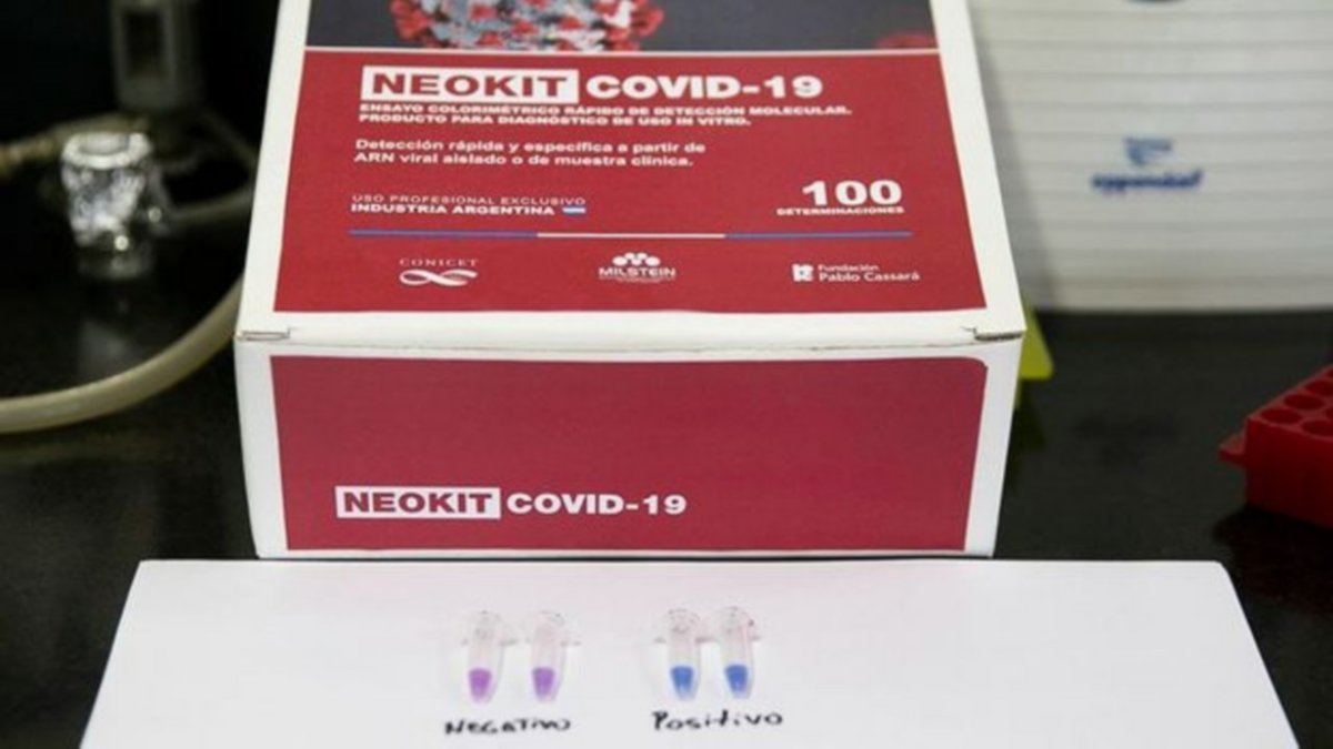 Un test argentino podría diagnosticar la variante Ómicron