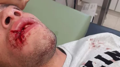 Otra vez golpearon brutalmente a un joven en Las Grutas