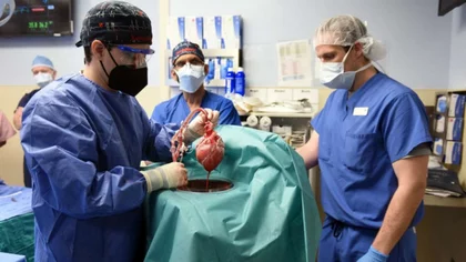 Hito: Trasplantaron el corazón de un cerdo ¡a un hombre!