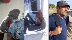 Confirmaron condena al policía que le disparó a un diputado