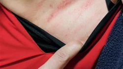 Agredieron a un enfermero en el hospital