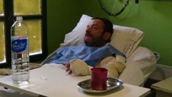 Un hombre fue quemado tras un violento ataque en El Bolsón
