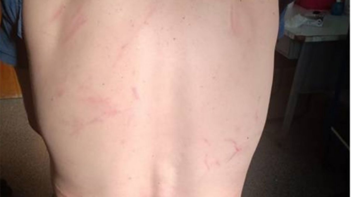 Policías lo molieron a palos por negarse a una alcoholemia