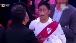 Confirmado: Rodrigo Aliendro sufrió fractura de malar