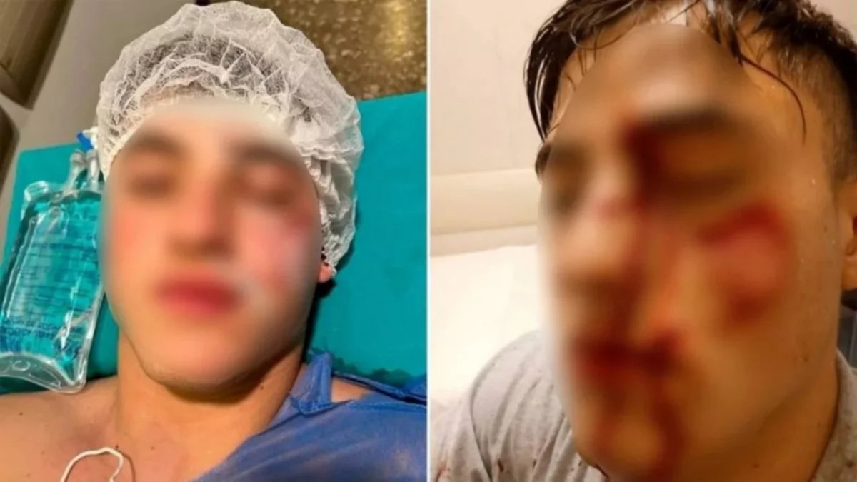 Lo vio hablando con su novia y le sacó un pedazo de cara con una botella