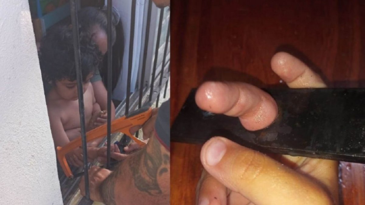 Se le atoró un dedo en la reja: ¡Bomberos de Centenario al rescate!