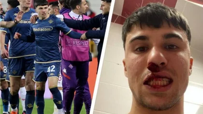 ¡Escándalo! Su equipo perdió y saltó a pegarle a un rival