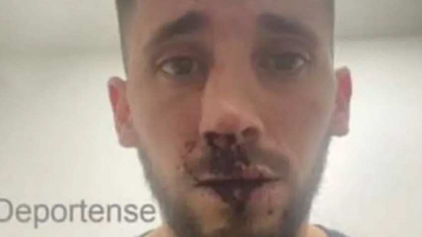 Un futbolista de primera fue agredido en un partido del ascenso