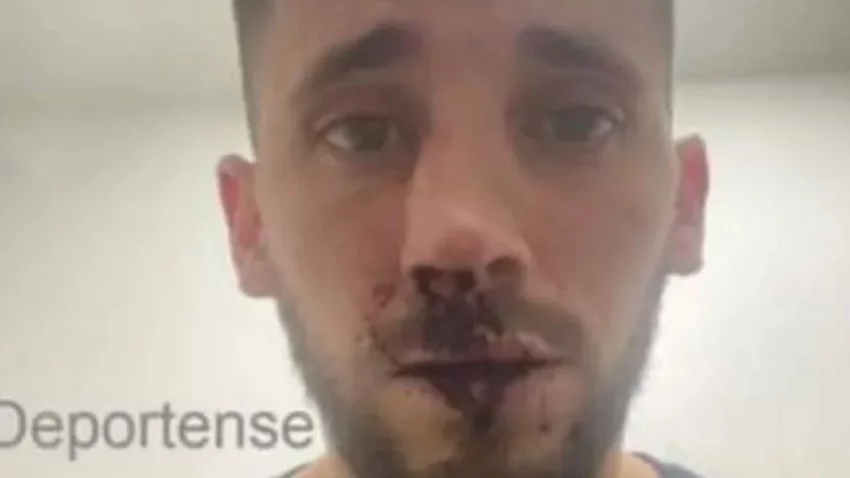 Un futbolista de primera fue agredido en un partido del ascenso