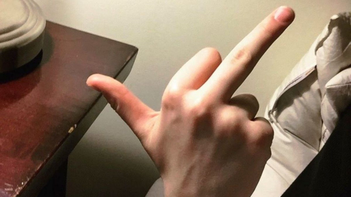 Se tropezó y quedó en estado de "fuck you" permanente